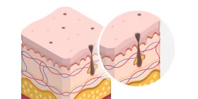 Treats Various Pigmentation Conditions
