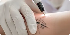 費用対効果の高い施術