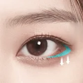 Eyelid Surgery