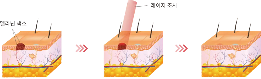 ピコプラス