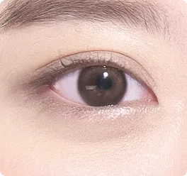 正常眼皮