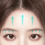 FOREVER Forehead & Sub-brow Lift