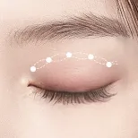 FOREVER Forehead & Sub-brow Lift