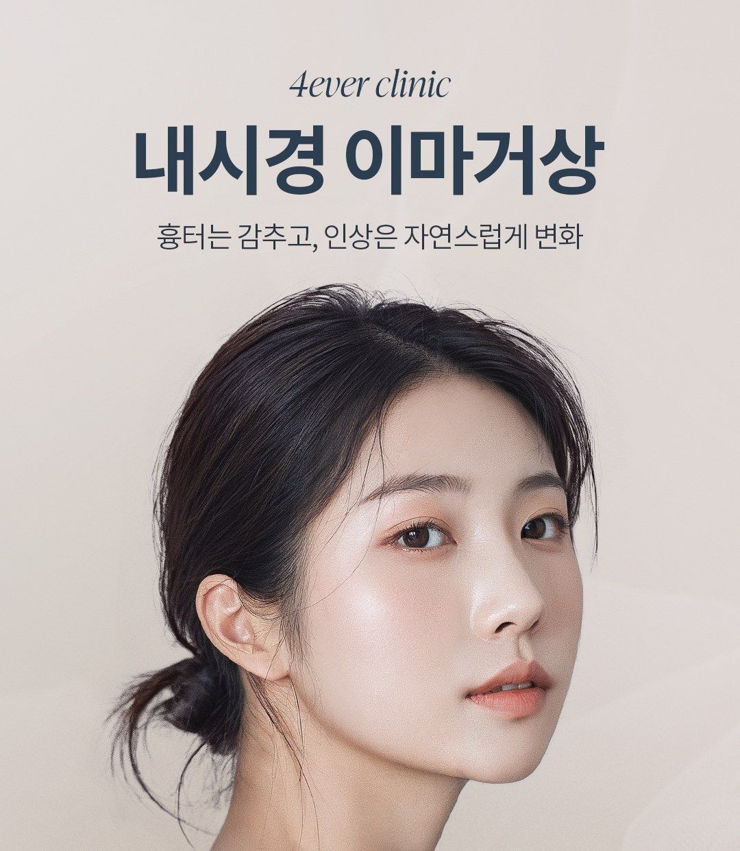 이마/눈썹하 거상