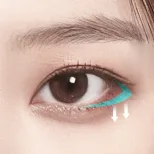 Signature Teuim Surgery