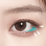 Signature Teuim Surgery